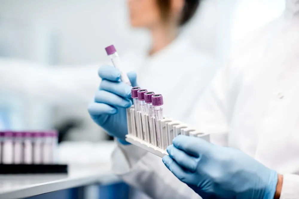 photo-laboratoire-bilan-LIMS